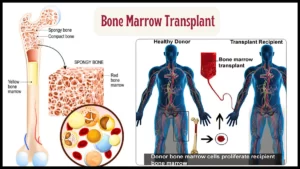 All about Bone Marrow